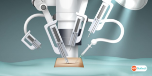 Robotic Surgery Treatment in India